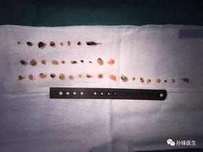 中国产纳米镜视频